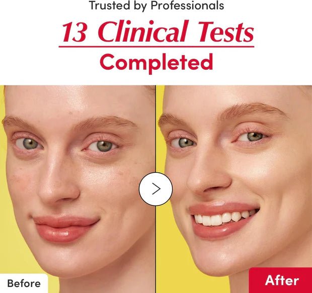 Eqqualberry Vitamin Illuminating Serum 30ml - Korean Beauty KR