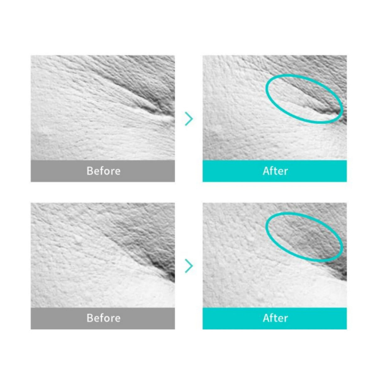 REJURAN Biome Healer Youth Formula Ampoule 30ml - Korean Beauty KR