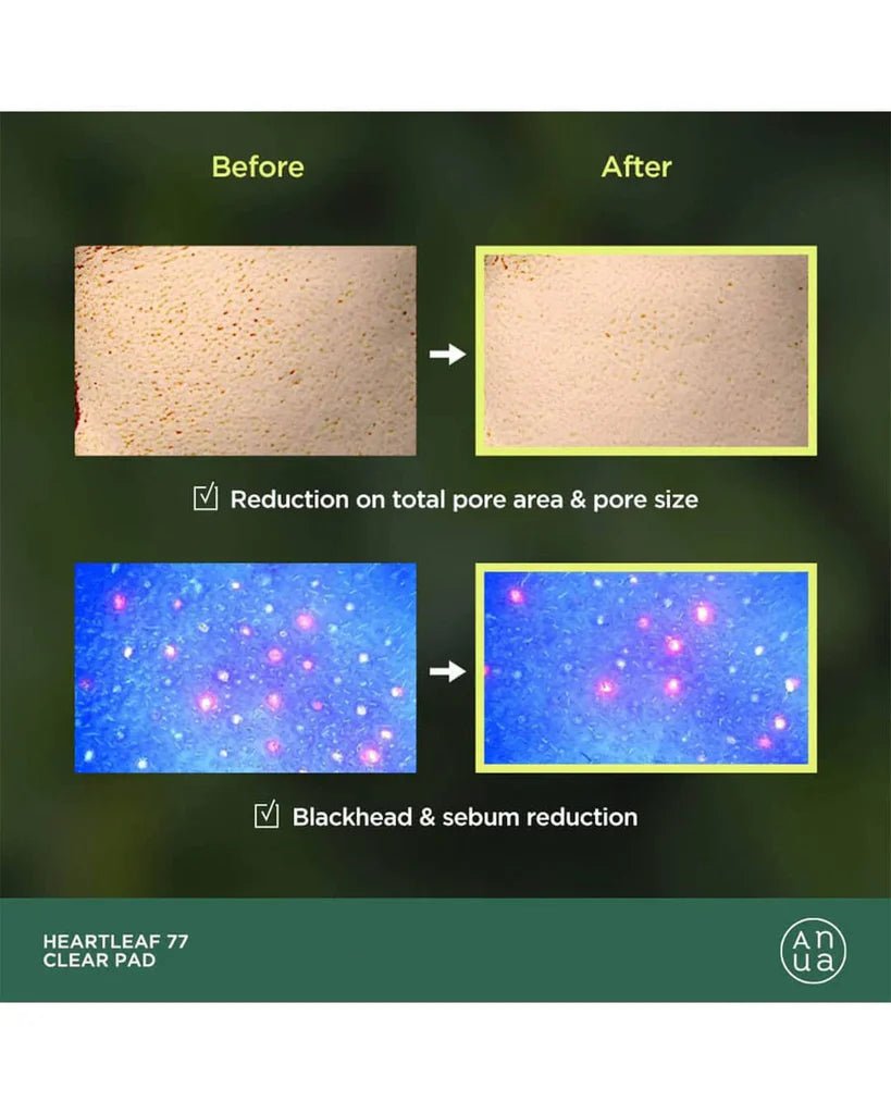 Anua Heartleaf 77% Toner Pad 70ea – Soothing & Hydrating Toner Pads for Sensitive Skin - Korean Beauty KR