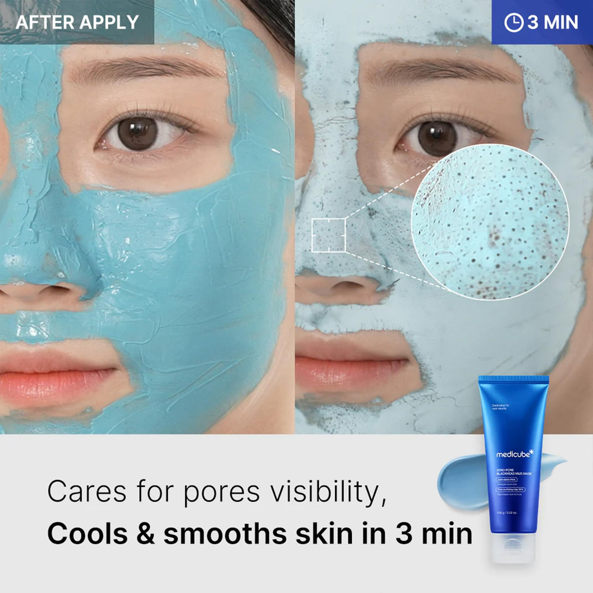 Medicube Zero Pore Blackhead Mud Mask 100g - Korean Beauty KR