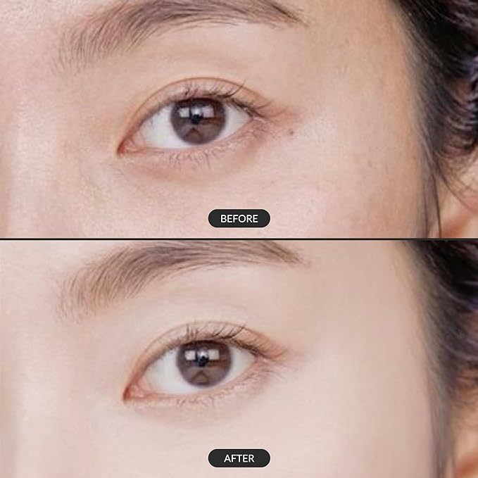 IPSE Premium Botonix Age - Defying Eye Concentrate – Anti - Aging & Firming Eye Treatment for Smooth, Revitalized Eyes - Korean Beauty KR