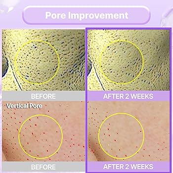 BIO HEAL BOH Probioderm Collagen Remodeling Cream 50ml – Firming & Rejuvenating Skincare for Youthful Skin - Korean Beauty KR