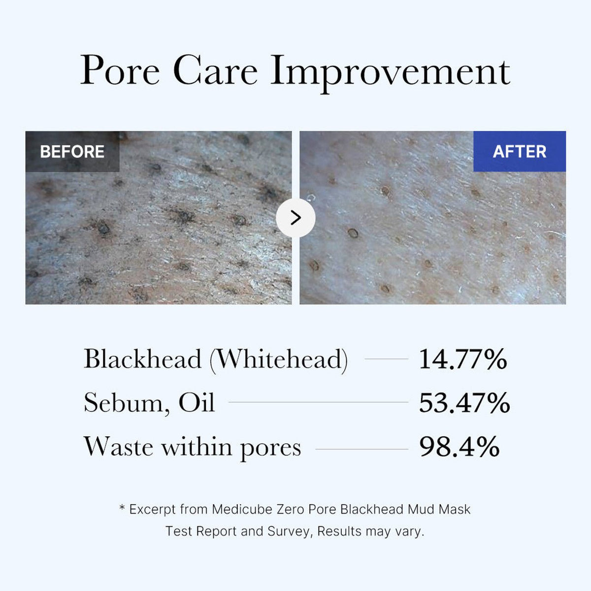Medicube Zero Pore Blackhead Mud Mask 100g - Korean Beauty KR