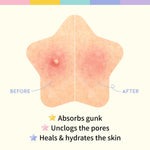 OOTD Beauty Star Spot Patch 80 Patches – Acne Treatment Patches for Clear, Blemish - Free Skin - Korean Beauty KR