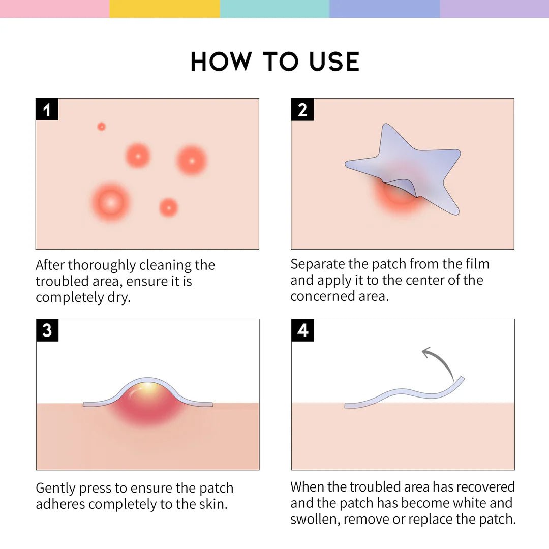 OOTD Beauty Star Spot Patch 80 Patches – Acne Treatment Patches for Clear, Blemish - Free Skin - Korean Beauty KR