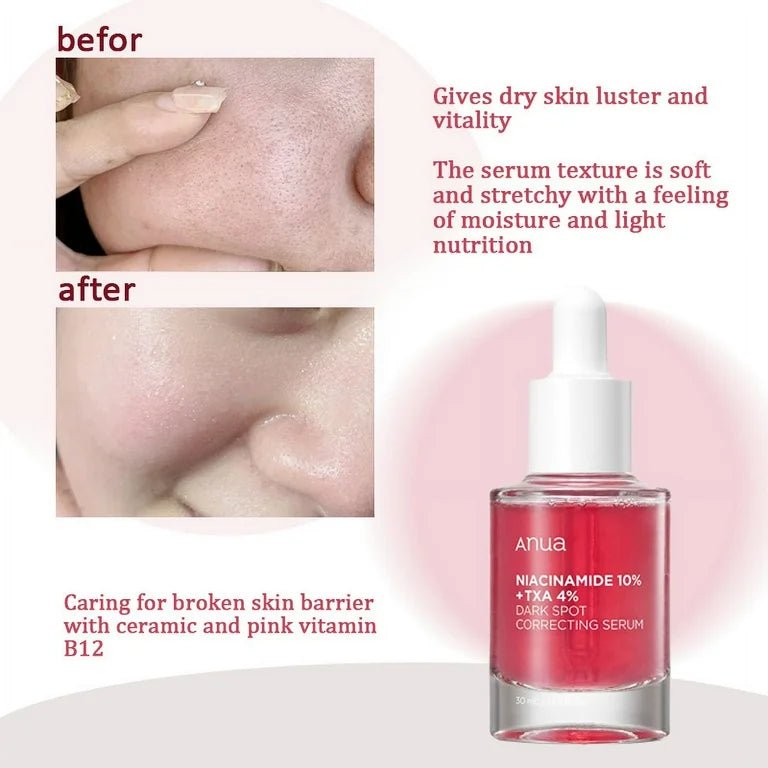 Anua Niacinamide 10% + TXA 4% Serum 30ml – Brightening & Skin Tone Correcting Serum - Korean Beauty KR