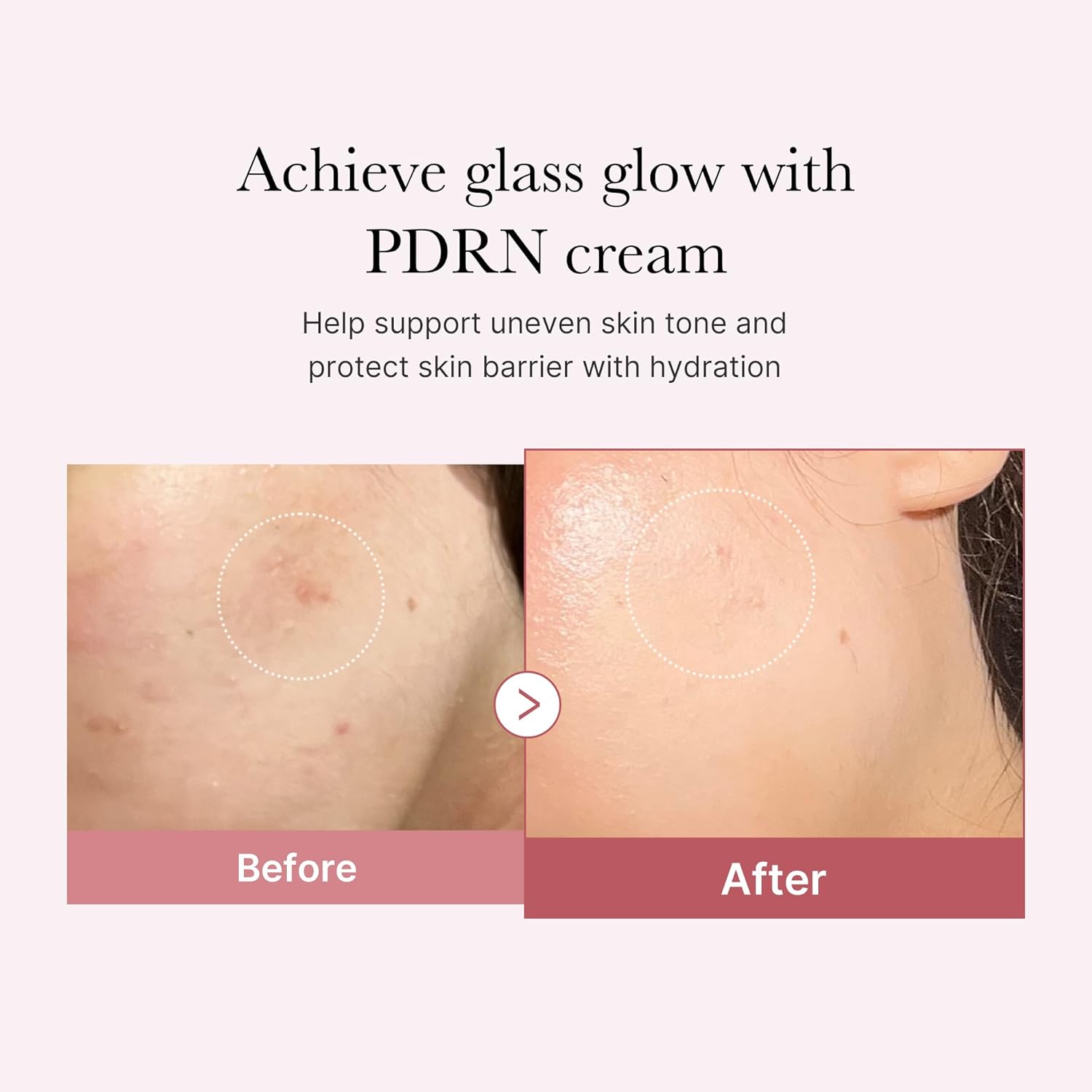 Medicube PDRN PINK HYALURONIC MOISTURIZING CREAM 50ML - Korean Beauty KR