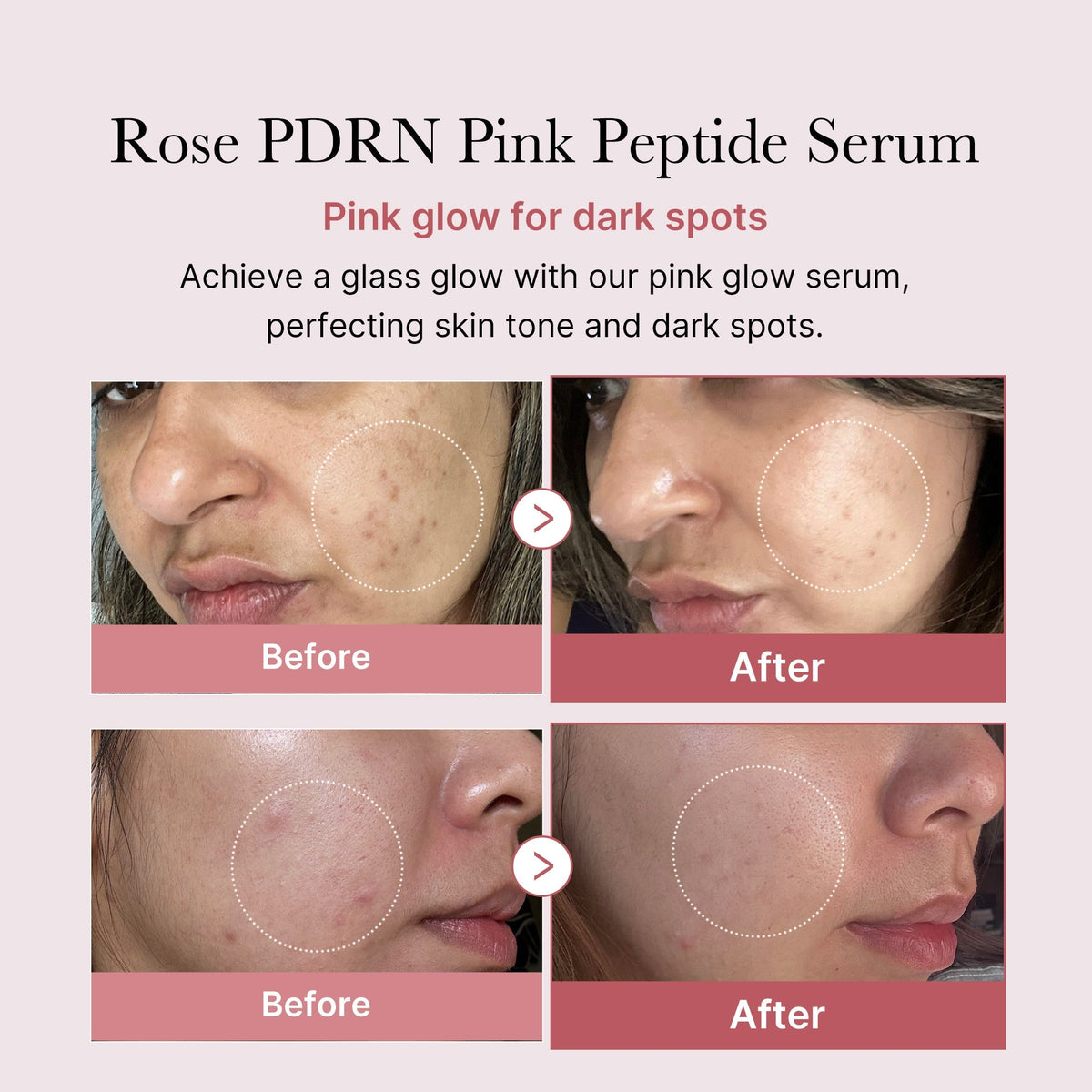 Medicube PDRN Pink Peptide Serum 30ml - Korean Beauty KR