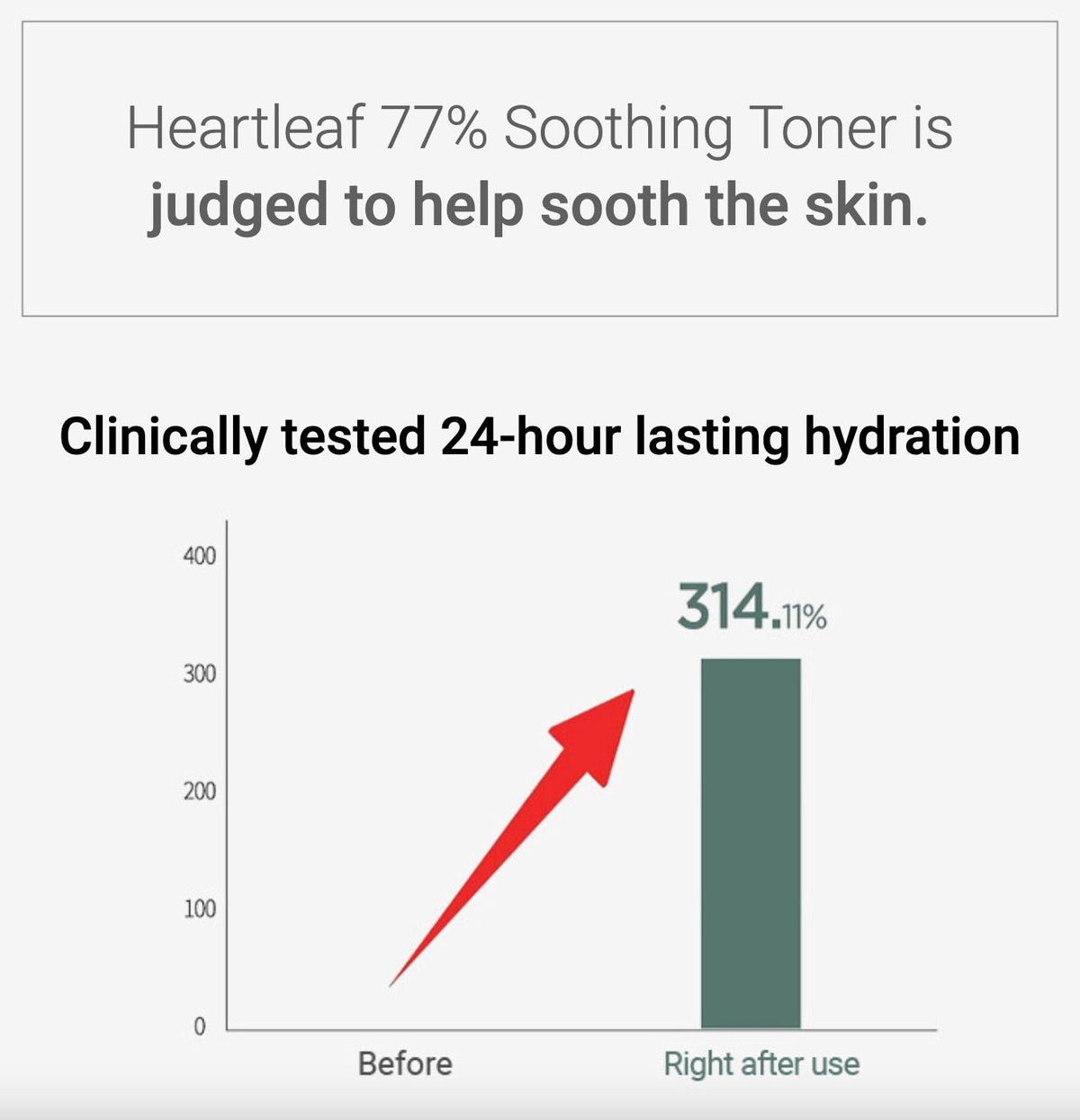 ANUA Heartleaf 77% Soothing Toner 250ml – Calming & Hydrating Toner for Sensitive, Balanced Skin" - Korean Beauty KR