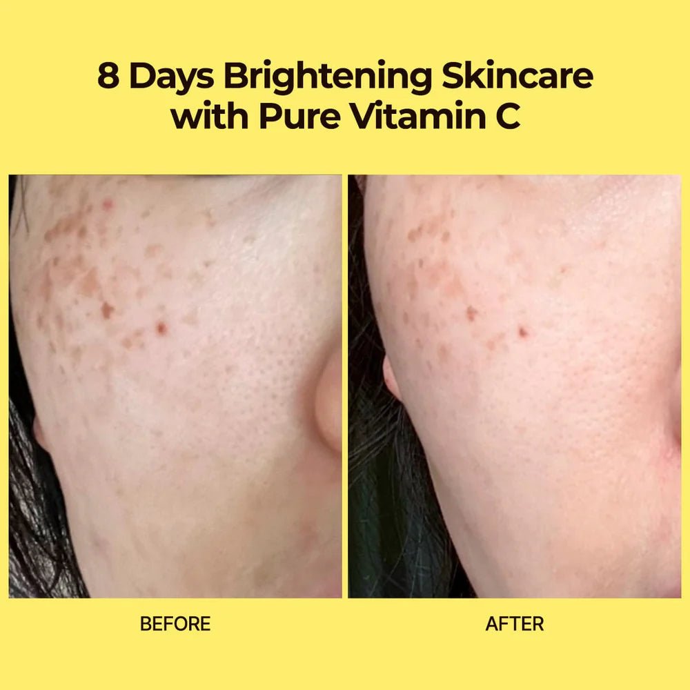 VARI:HOPE 8 Days Pure Vitamin C Cream 50ML – Brightening & Revitalizing Cream - Korean Beauty KR